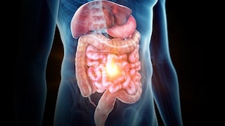 How Does a Colonoscopy Affect the Risk of Colon Cancer?