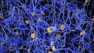 Alzheimer's Disease Under the Microscope