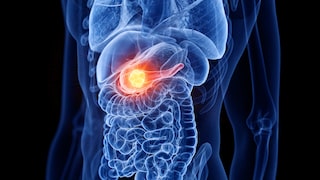 Researchers are testing a newly developed drug against key tumor drivers.
