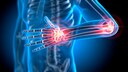What Causes Mysterious Swellings and How the Condition Significantly Alters the Daily Lives of Those Affected