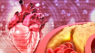 Is Running a Marathon Harmful to the Heart?