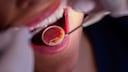 How Does Carbonation Affect Tooth Enamel?