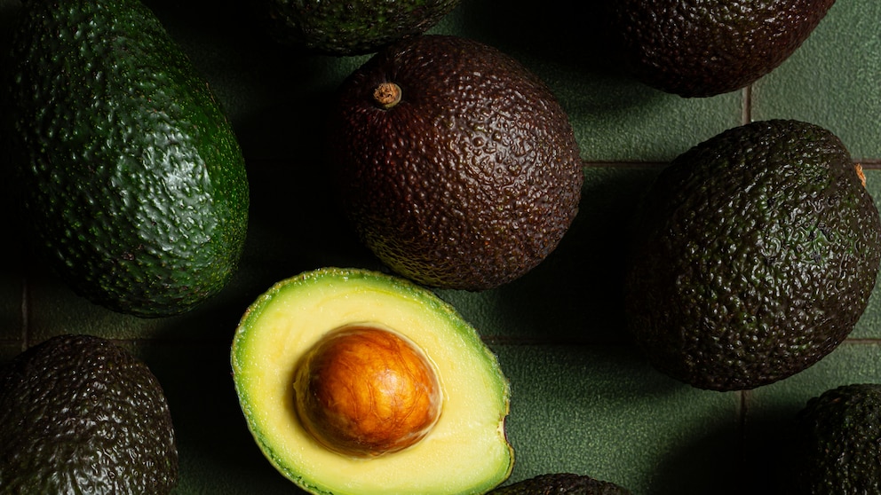 Avocado Cholesterol