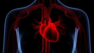 A case report reveals why a 65-year-old woman suddenly went to the hospital with chest pain after her daughter's wedding.