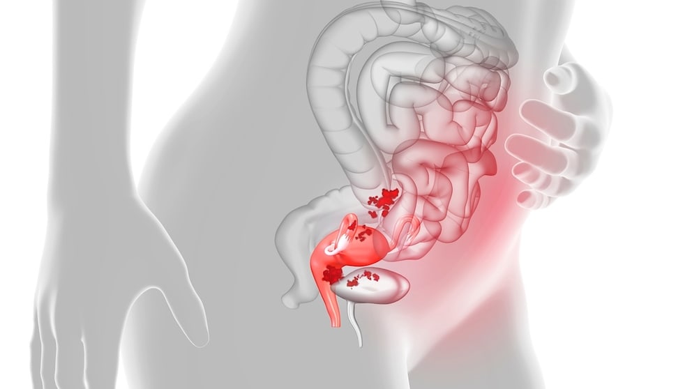 Certain foods are beneficial for women in menopause, according to an expert.