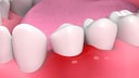 teeth