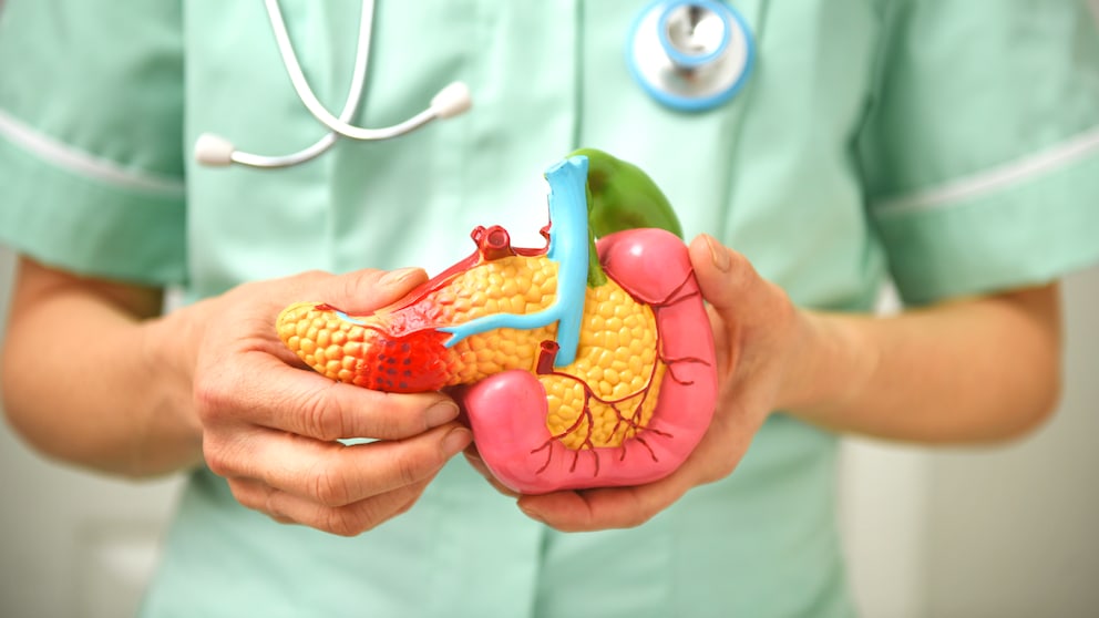 A new test aims to help detect pancreatic cancer more effectively and at an earlier stage.