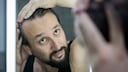According to researchers, a medication for arthritis may also help with hair loss.