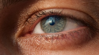 Can the Eye Indicate Skin Cancer Risk?