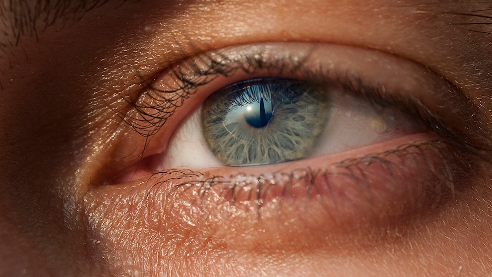 Can the Eye Indicate Skin Cancer Risk?