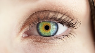 Pterygium is a growth in the eye that has now been linked to skin cancer.