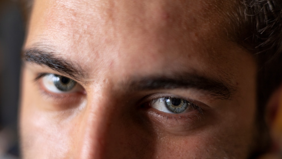 The active ingredient Tadalafil, found in erectile dysfunction medications, may potentially increase the risk of a serious eye disease.