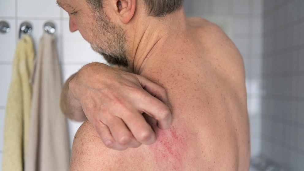 Certain skin changes may indicate dermatophilosis.