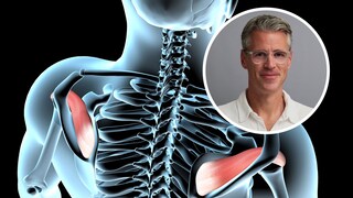 3 Exercises I Avoid at the Gym as an Orthopedist