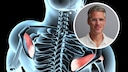 3 Exercises I Avoid at the Gym as an Orthopedist