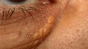eye