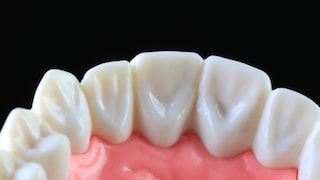 Periodontitis is being studied in connection with Alzheimer's