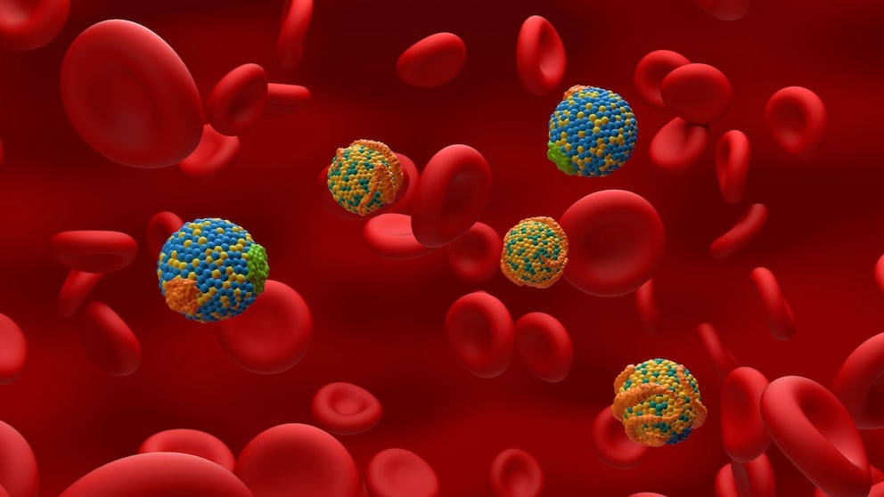 Blood lipids influence the risk of stroke and heart attack, particularly triglycerides and cholesterol.