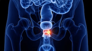 Prostate