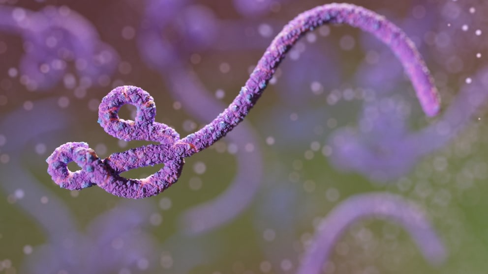 Ebola is also known as Ebola virus disease or Ebola fever.