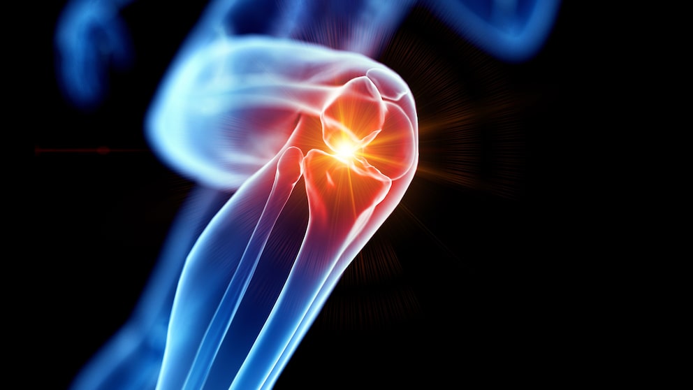 Exercise Is Important for Healthy Bones and Joints