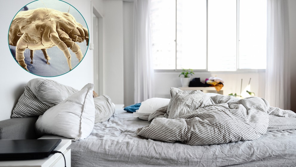 House dust mites are found in every home. They feed on skin flakes, among other things.