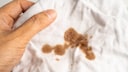 Food stains, in particular, can be effectively removed with a very specific household remedy