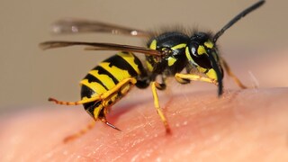 Wasp Stings Skin