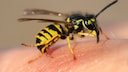 Wasp Stings Skin