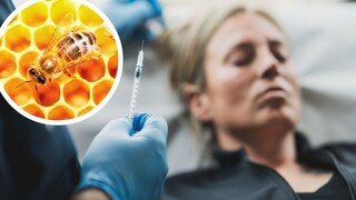 Honeybee Collagen on Honeycomb and Wrinkle Treatment with Hyaluronic Acid (Stock Image)
