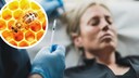 Honeybee Collagen on Honeycomb and Wrinkle Treatment with Hyaluronic Acid (Stock Image)