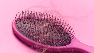 Hair loss after giving birth affects many women, but few talk about it. Our author wants to change that!
