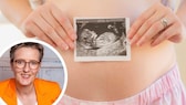 Even before the first ultrasound, there are symptoms that indicate a pregnancy. Our expert reveals what they are.